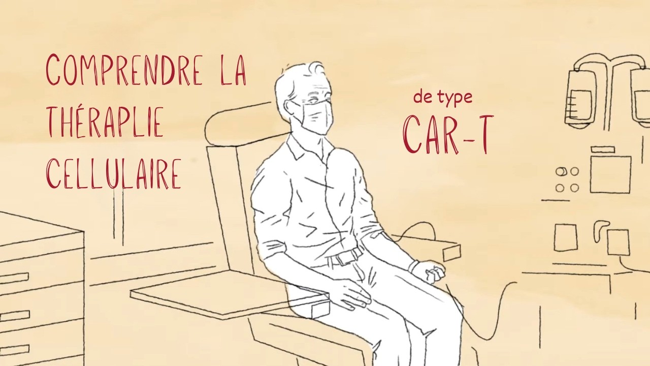 Le myélome multiple : CAR-T