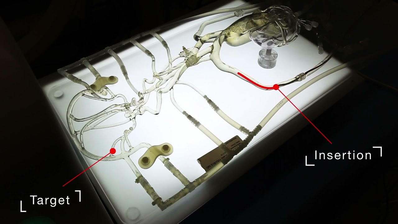 Dexterous helical magnetic robot for improved endovascular access (Supplementary Video 2)