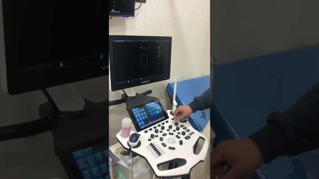 Vinno شرح سونار