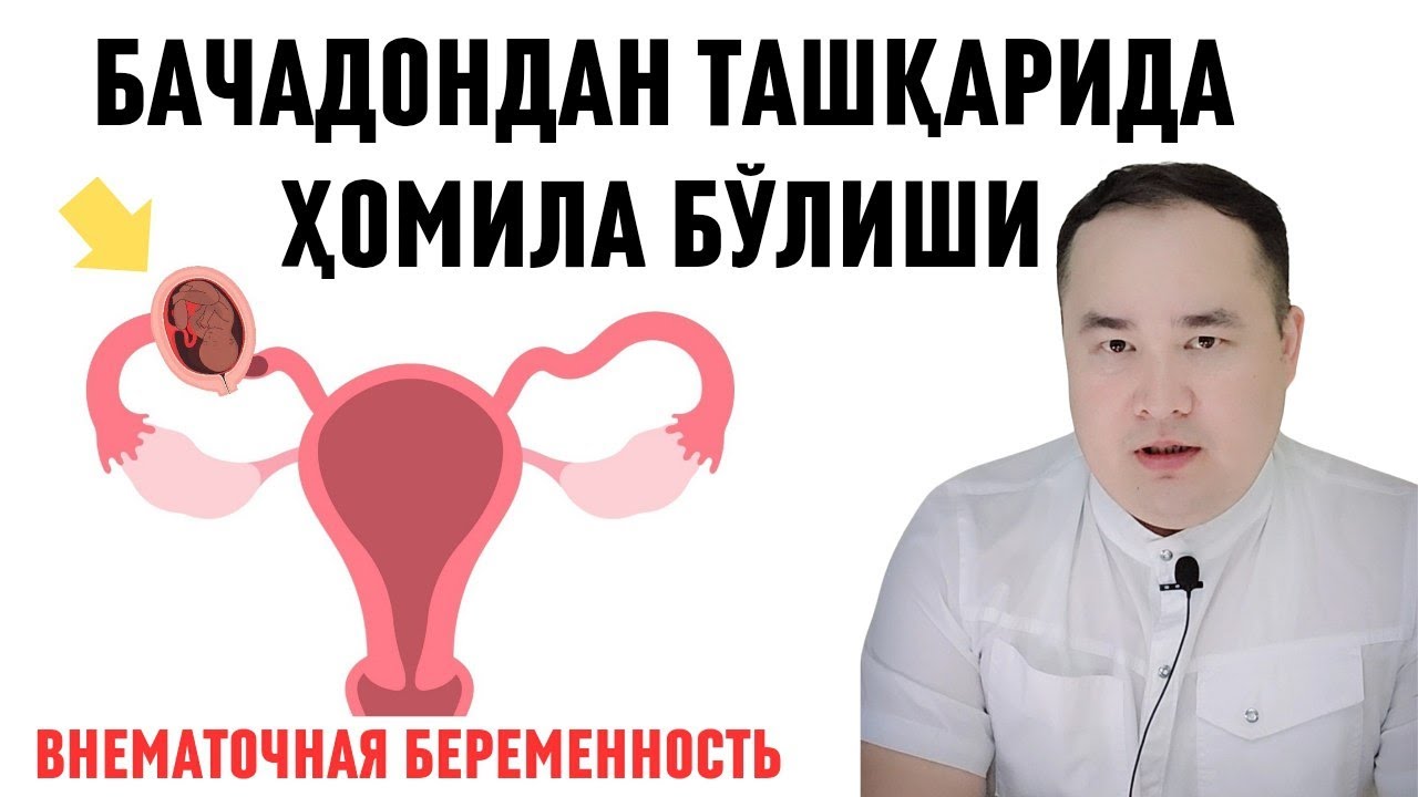 БАЧАДОНДАН ТАШҚАРИ ҲОМИЛА БЎЛИШИ, САБАБИ, БЕЛГИСИ, АСОРАТИ, ОЛДИНИ ОЛИШ ҲАҚИДА ИСЧАНОВ