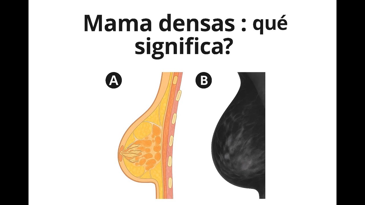 ¿Qué significa tener mamas densas? Es peligroso ??== | Clasificación ACR BI-RADS