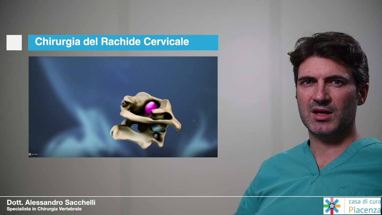 Dott. Alessandro Sacchelli - Chirurgia del Rachide Cervicale