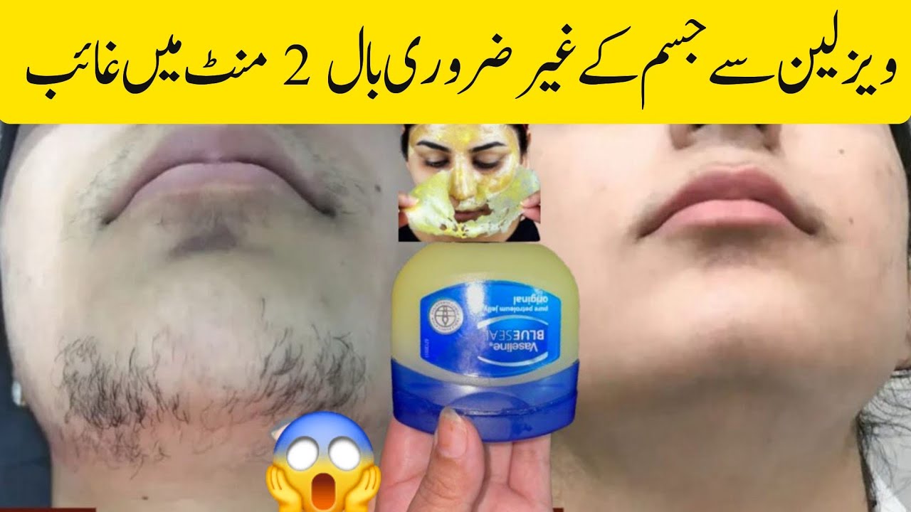 Without threading👉🏻😱I'm surprise how aunty's beard &moustache removed|facial hair removal at home