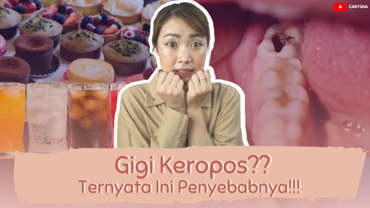 KETAHUI PENYEBAB GIGI KEROPOS YANG BIKIN SAKIT GIGI | Lifestyle Sehat