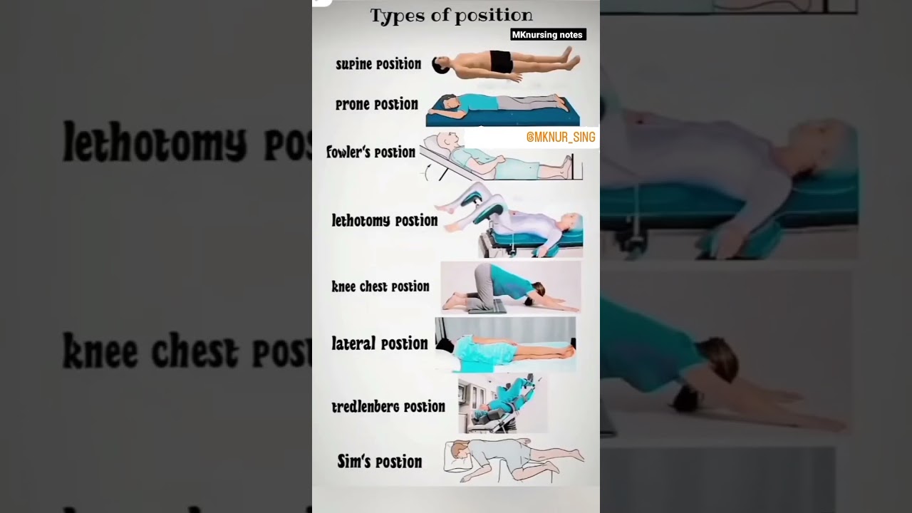 Types of position #nursing #gnm #notes #nursingexamprepration #nursingexam #postbscnursing