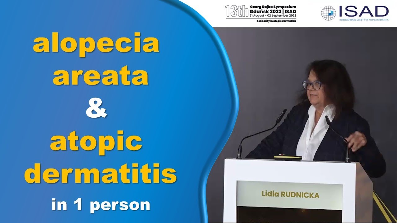 Alopecia Areata And Atopic Dermatitis: A Combined Approach