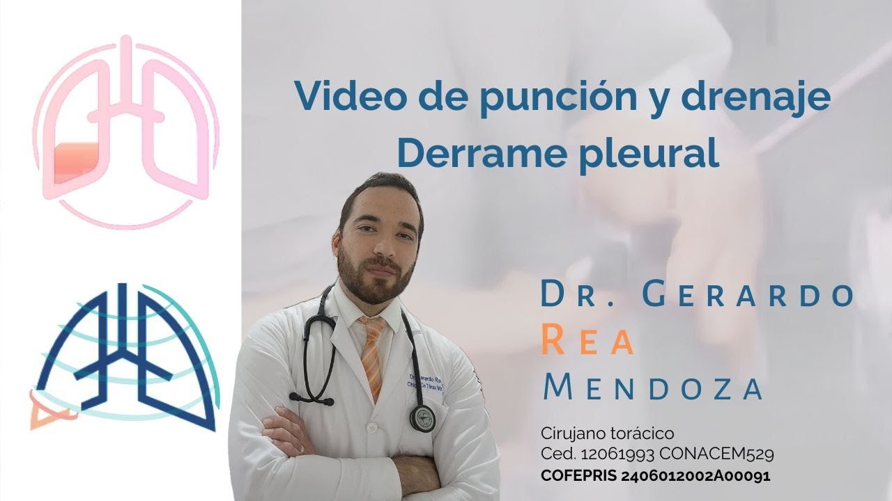 Punci&oacute;n y drenaje de derrame pleural