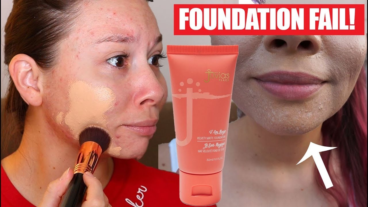 JUVIA'S PLACE I am Magic Foundation FAIL! | Acne