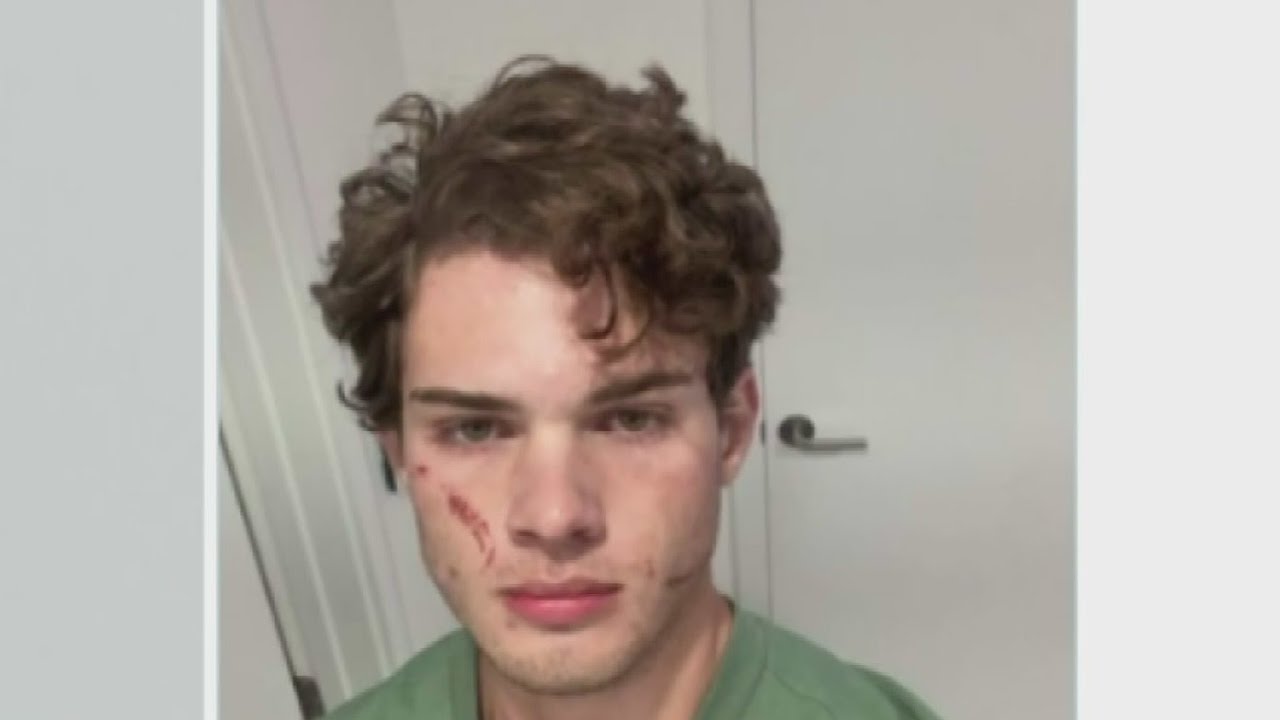 Clavicular responds after suspected overdose during Miami livestream lands him in hospital
