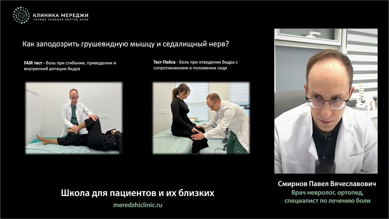 Синдром грушевидной мышцы. Реальные и нереальные случаи