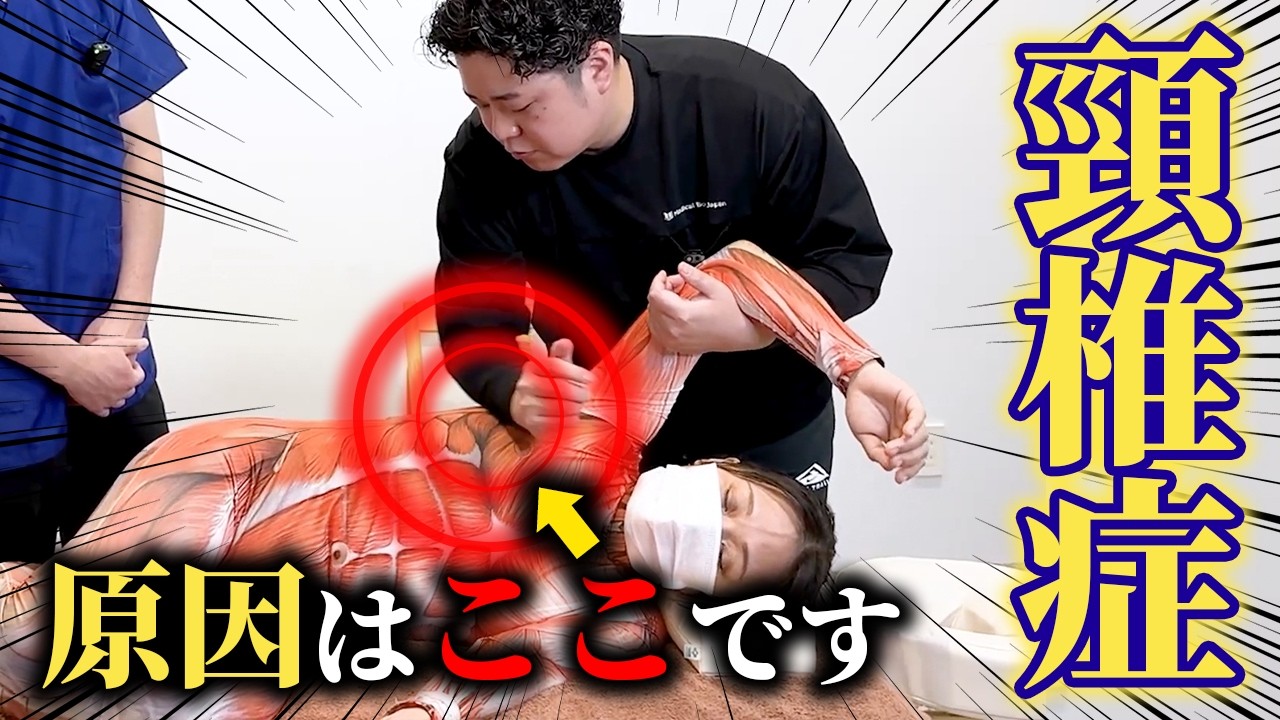 【頚椎症】下位頚椎の過可動性を抑制する、前鋸筋へのアプローチ