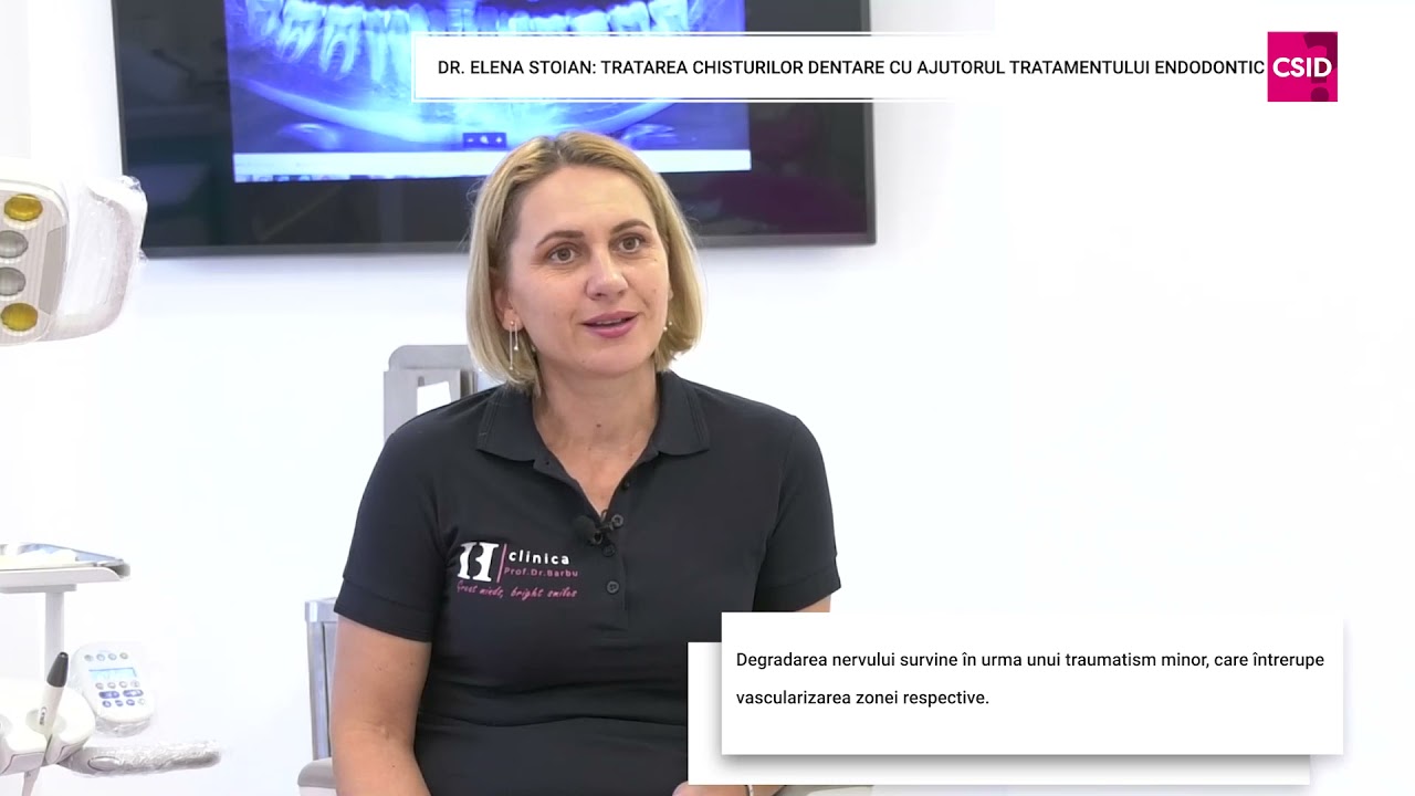 Chisturile dentare: cum se tratează- Dr. Elena Stoian