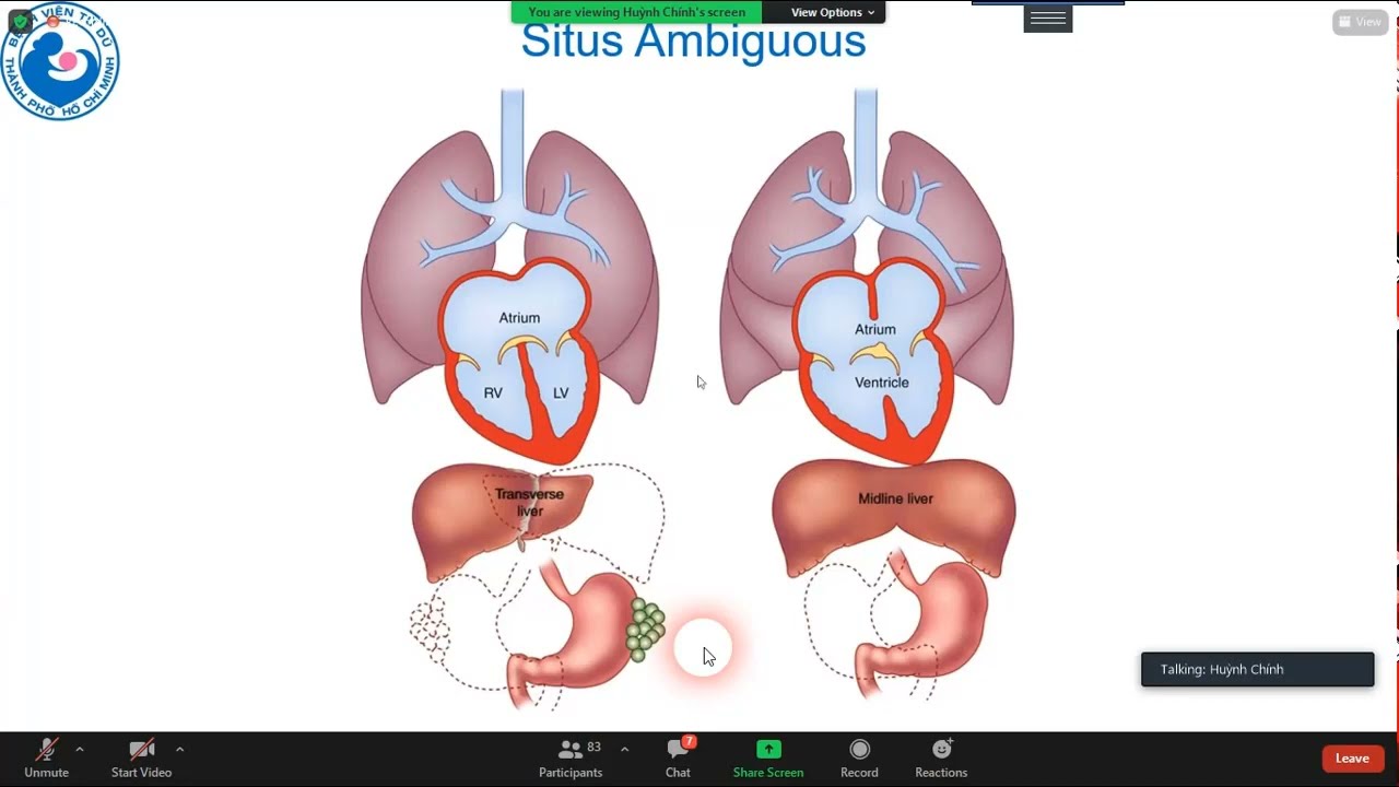 02 Các mặt cắt cơ bản và tối ưu hóa hình ảnh trong siêu âm tim thai - ThS.BS. Huỳnh Chính