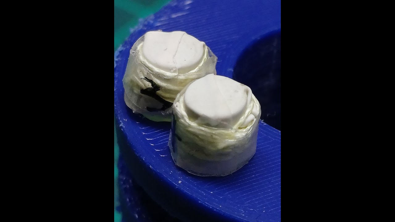 4 ФЕВРАЛЯ ДИСПЕНСЕР НАХЛЁСТ УДАЧНО