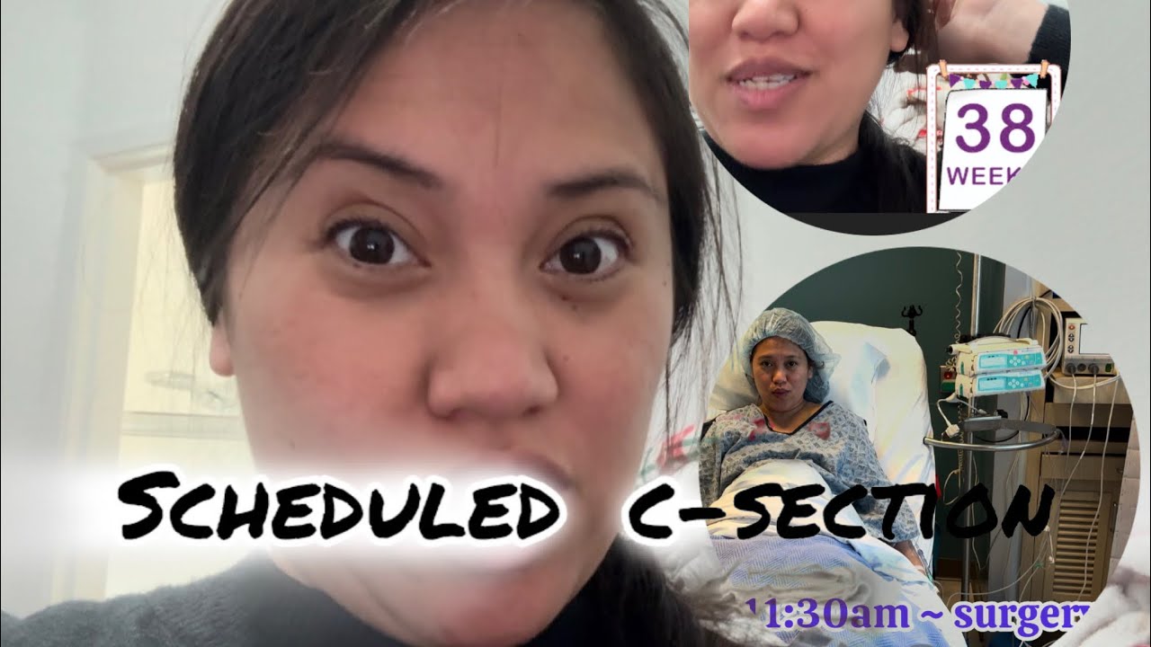 Scheduled C-scection came early😮🤰🏻👶🏻 #MineVlog040 #baby #Csection #AwesomeGOD #ThankYouLord 