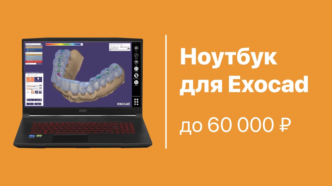 Ноутбук для EXOCAD до 60 000 рублей. На что обратить внимание при выборе ноутбука под Exocad?