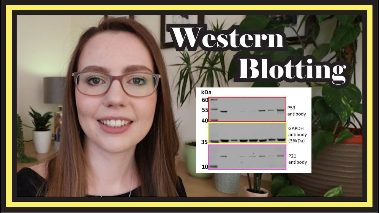 Western Blotting  |  Beginner Data Interpretation Tutorial & Step-by-Step Protocol Explained