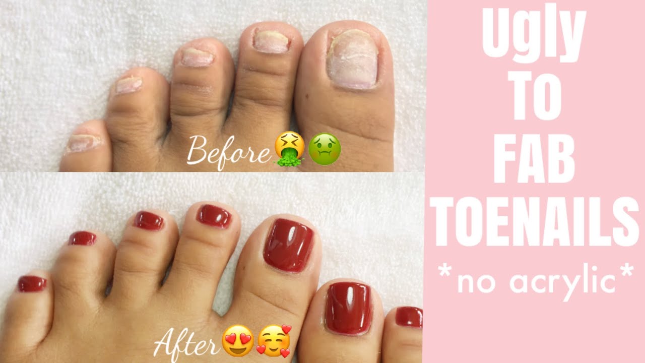 TOENAILS TRANSFORMATION 😍😱*No Acrylic* |•| EASY & SUPER AFFORDABLE |•|