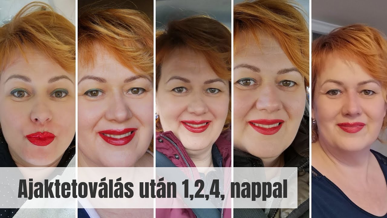 Ajaktetoválás után 1,2,4 nappal