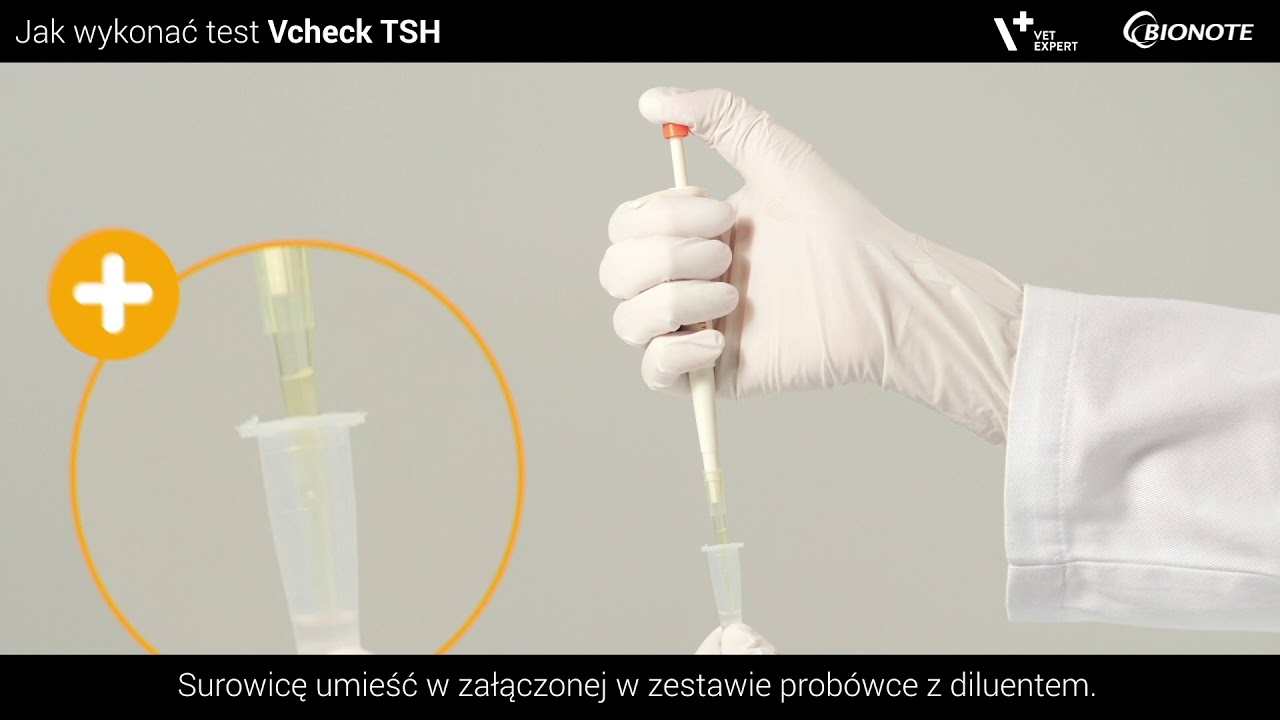 Vcheck TSH