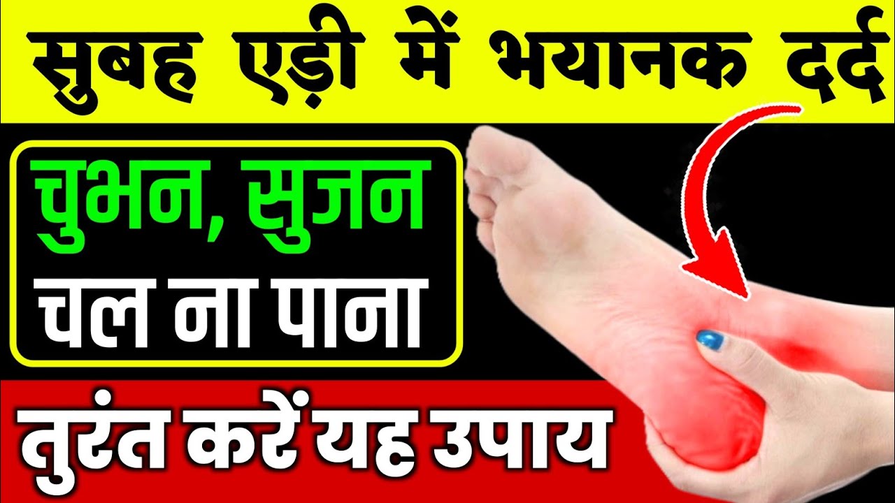 इन विटामिन्स से एड़ी का दर्द ठीक करें|Heel Pain Treatment|Uric Acid In Heel Pain
