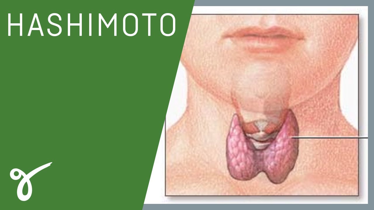 Hashimoto: So ernährst du dich richtig, ohne auf alles verzichten zu müssen | Mit DR. AMBROSIUS
