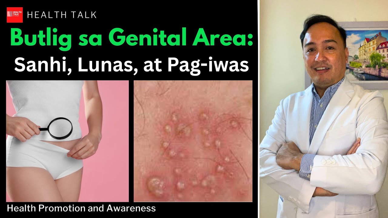 Butlig sa Genital Area: Sanhi, Lunas, at Pag-iwas