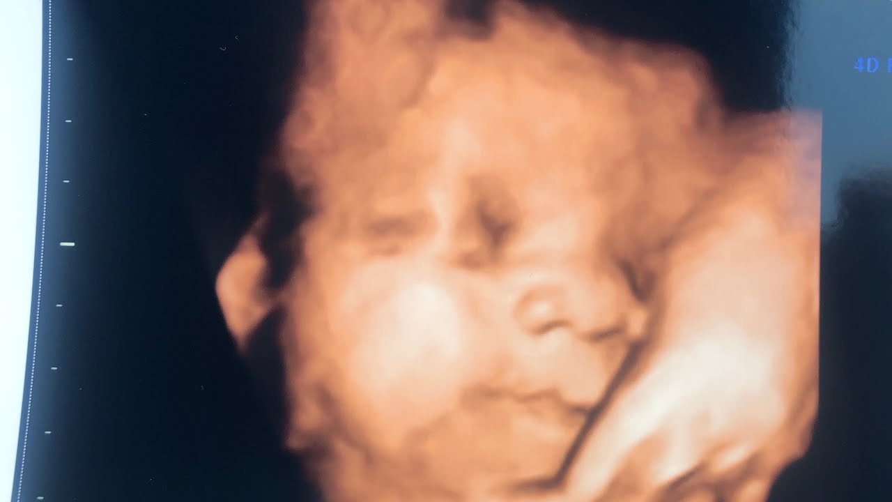 BEST 3D/4D ULTRASOUND OF BABY AT 32 WEEKS PREGNANT * SURPRISE GENDER