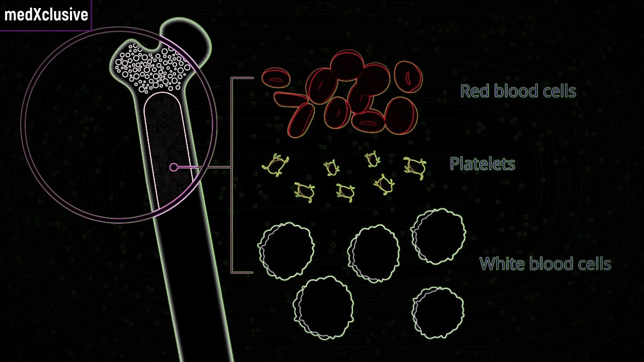 Understanding Splenomegaly in Myelofibrosis (MF)