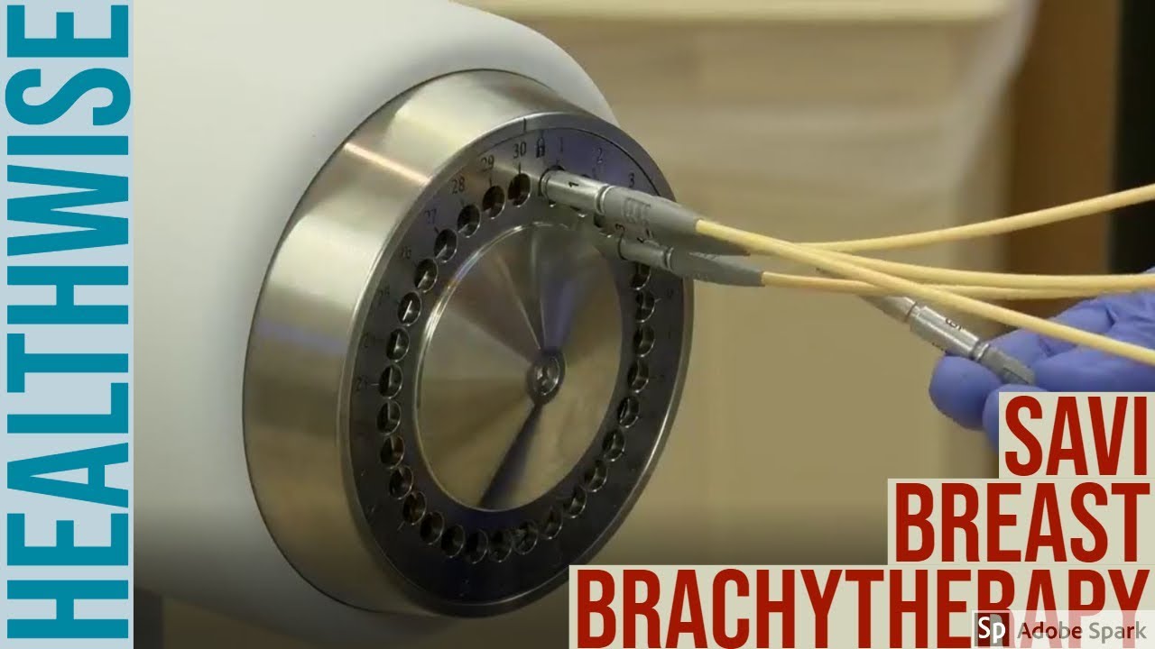 SAVI Breast Brachytherapy