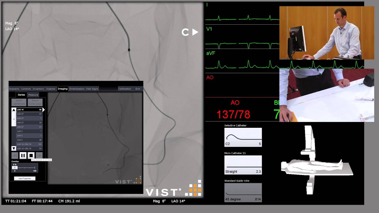 Uterine Artery Angiogram