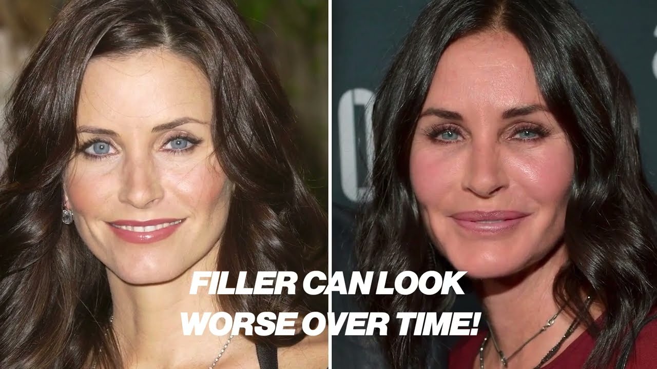 Dr Abs: How to tighten Your Face Without Filler or  Botox - live demo Sunekos