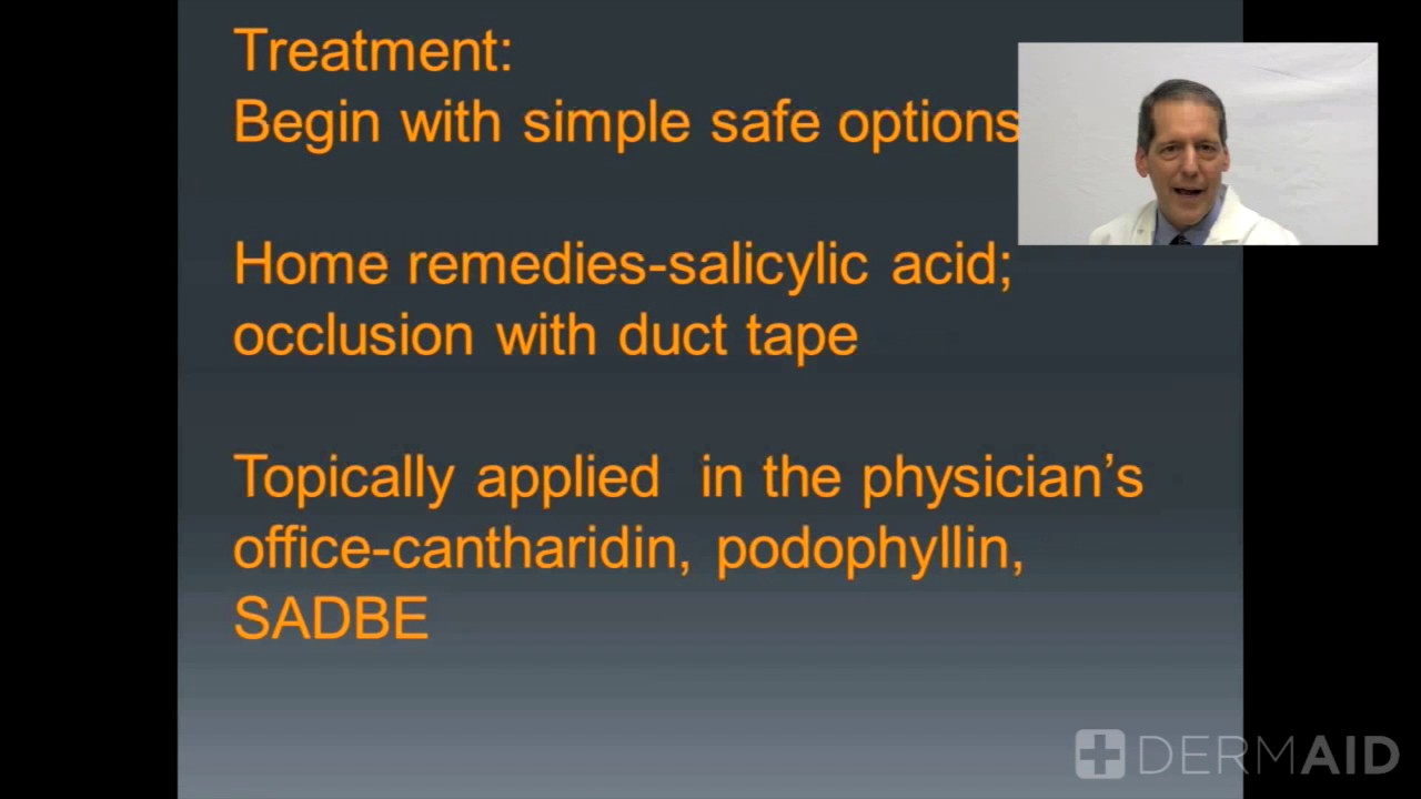 Wart Treatments