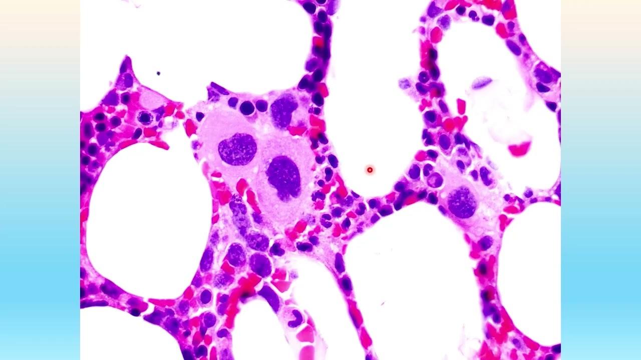 AP-IAP 2025, Hematopathology, Julia T. Geyer