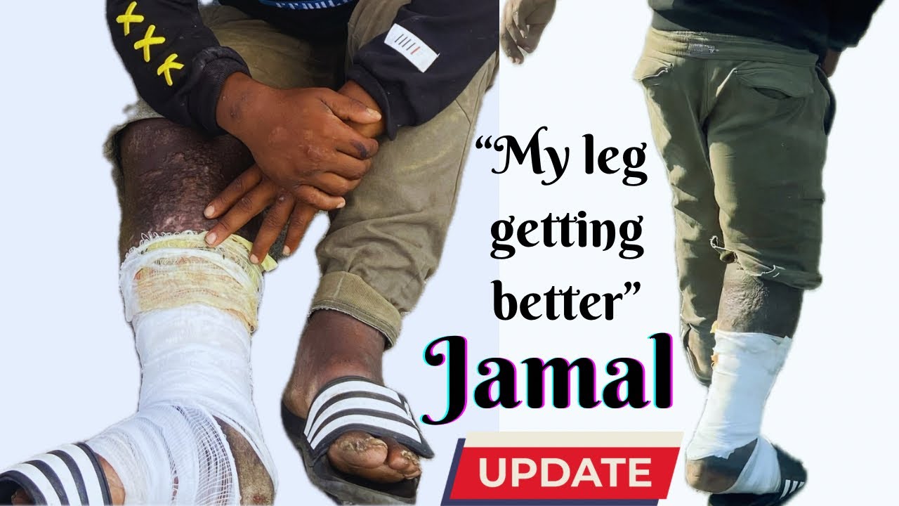 Jamal - “I Still Got My Leg” (UPDATE)