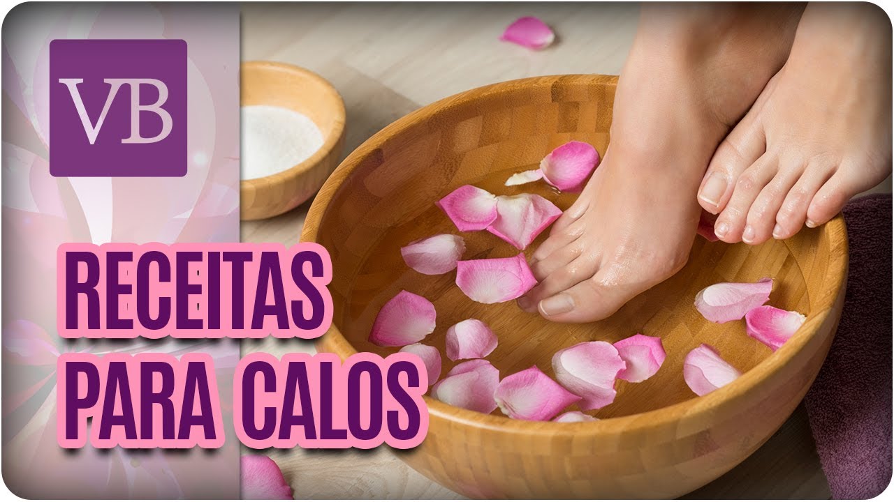Receitas Caseiras Para Calos - Você Bonita (10/08/17)