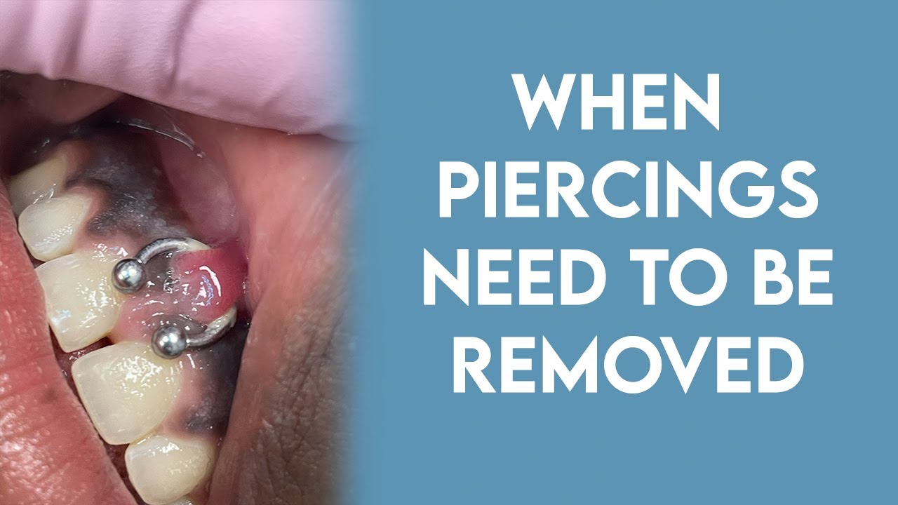 When Piercings Need to be Removed