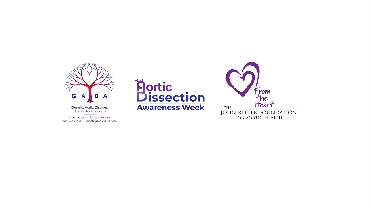 Dr. Siddharth Prakash Exercise and activities after an aortic dissection | ADAW2020