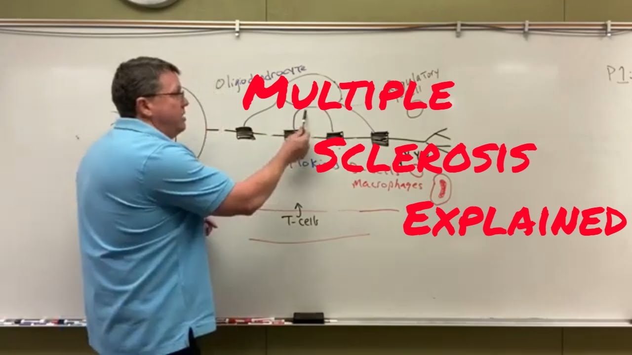 Multiple Sclerosis