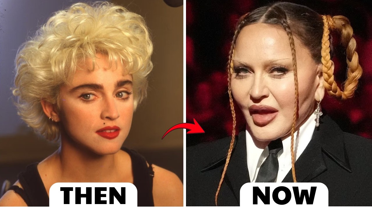 20 Celebrity Plastic Surgery Transformations That Surprised Fans | Then and Now 2026