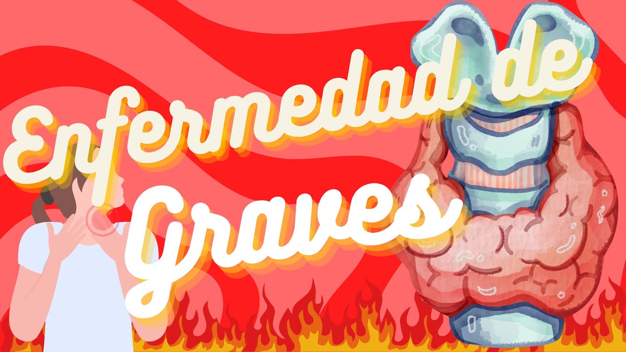 Enfermedad de GRAVES