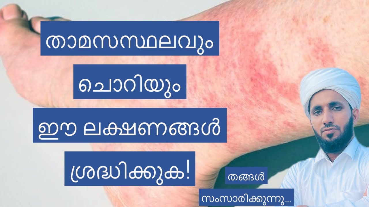 വീട്ടിൽ ചൊറിയുള്ളവരുണ്ടോ?കാരണം ഇതാണോ? താമസസ്ഥലവും ചൊറിയും! about Psoriasis ( THANGAL TALK)