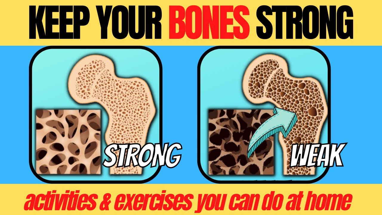 Prevent Osteopenia and Osteoporosis | Doc Cherry