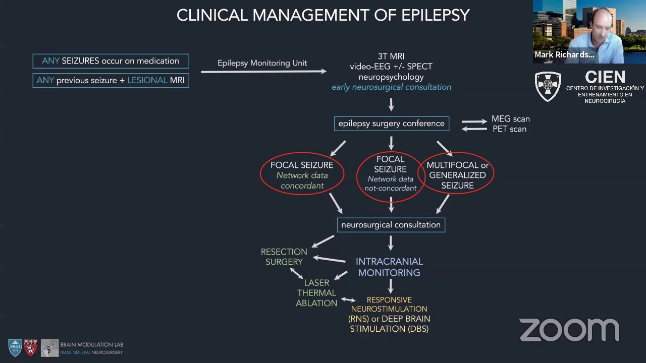 19. Modern Epilepsy Evaluation and Avanced Treatment Options by Dr. Mark Richardson