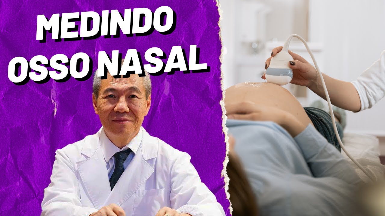 AO VIVO: MEDIDA DO OSSO NASAL!