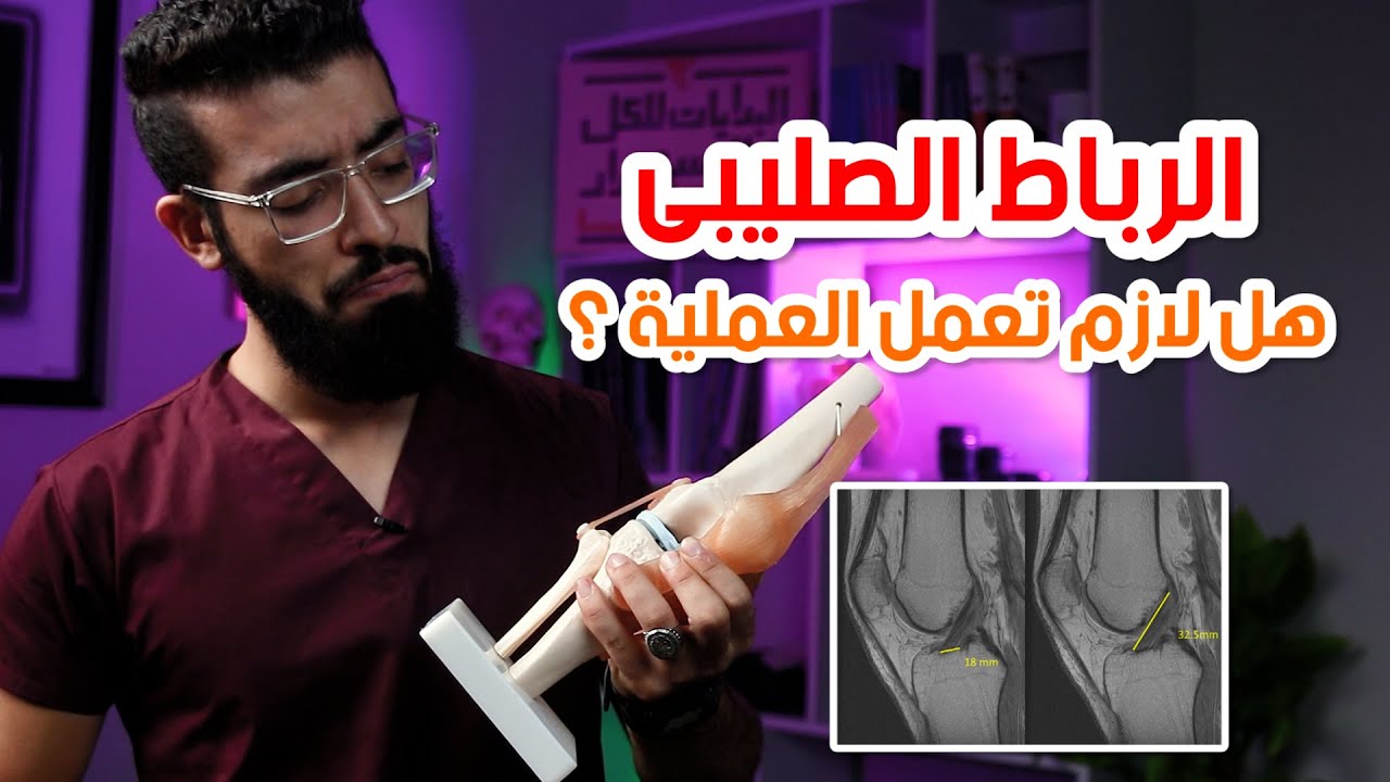اتصابت بالصليبى .. هل مفيش حل غير الجراحة ؟ | متى تكون جراحة الرباط الصليبى واجبة ومتى تكون مكروهة ؟