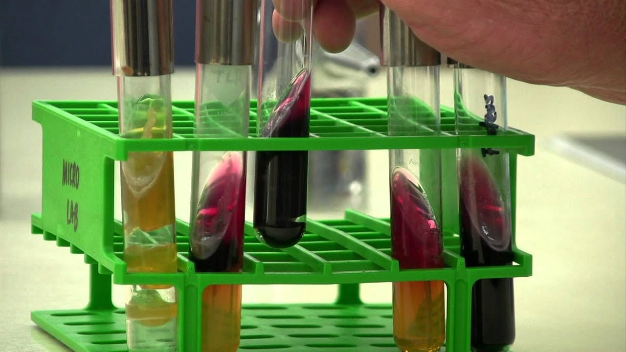 Triple Sugar Iron agar slants