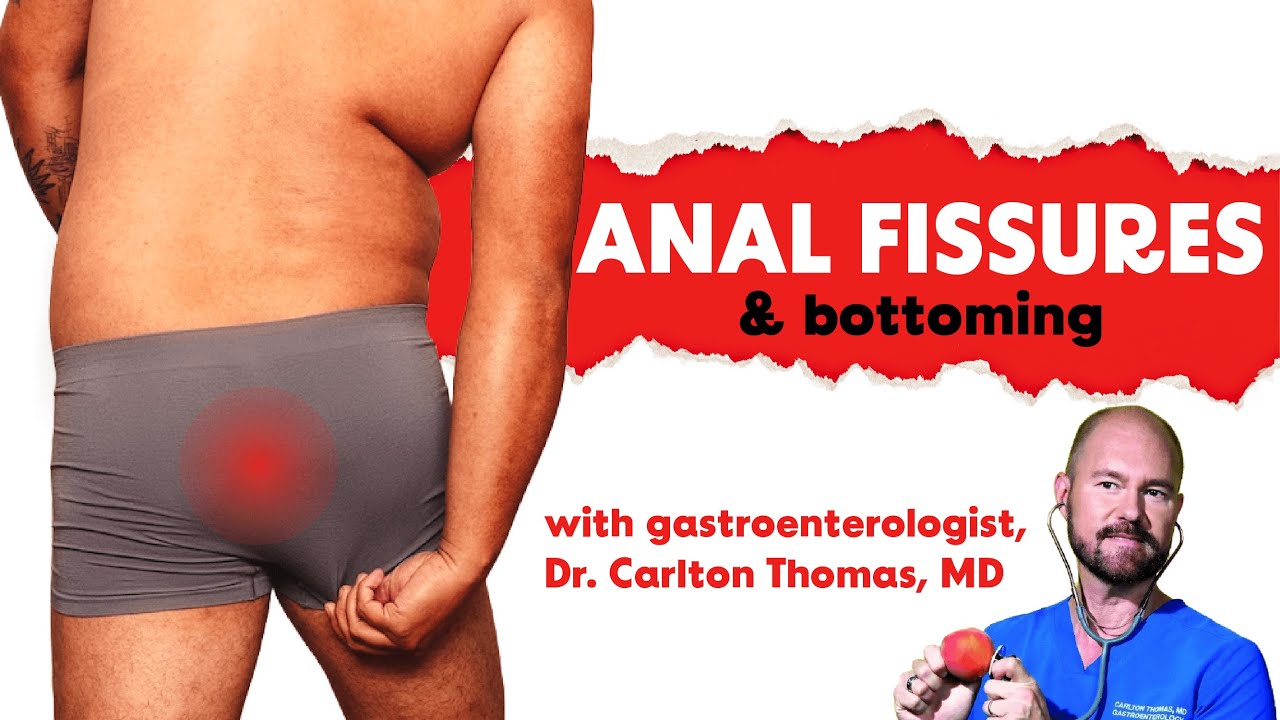 We asked a gay G.I. doctor how to treat and prevent anal fissures (especially for bottoming)