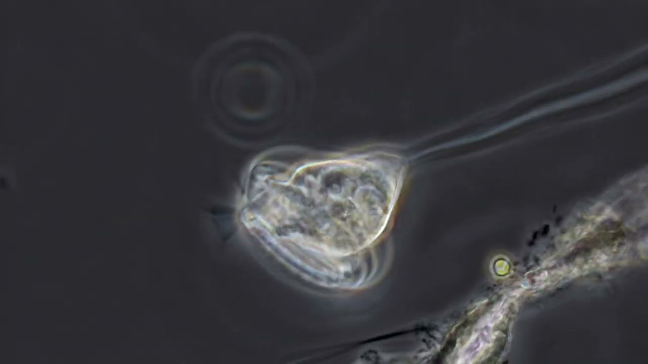 Vorticelles