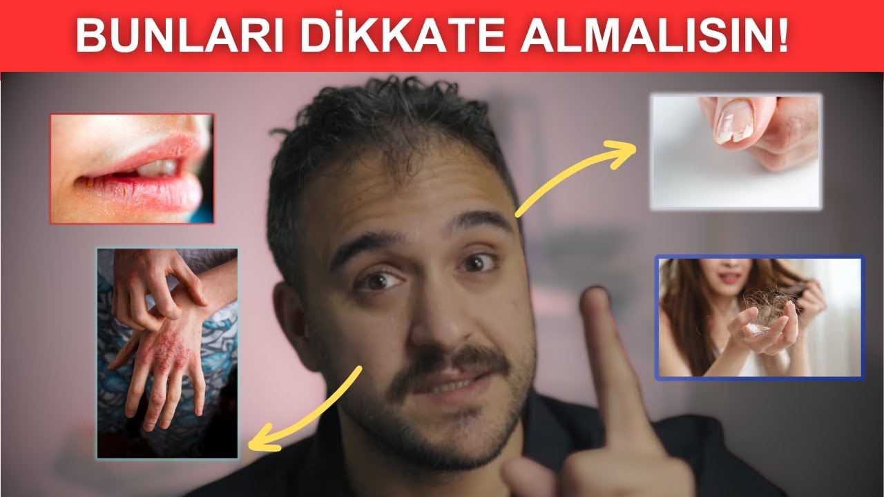 12 BELİRTİYLE HANGİ VİTAMİNİN EKSİK ANLA!